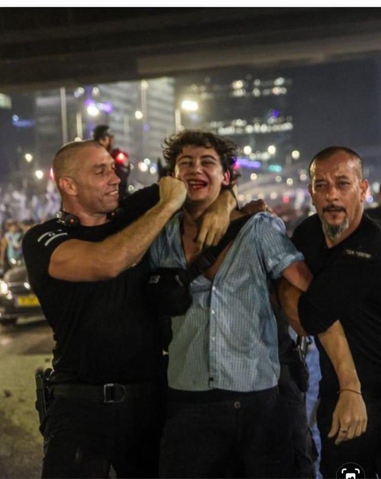 הבחור הצעיר והנפלא הזה , כבן 18, חטף מכות קשות. ונעצר. הפוסט של אימו המודאגת והגאה , יפעת, רץ ברשת. מבינה אותה לגמרי.
השוטרים המחייכים וגאים ככל הנראה באלימותם , מעלים את הסעיף…ואם היית רואה את זה הייתי צורחת על השוטר כמו שכבר עשיתי לא פעם. ויש סיכוי שזה היה נגמר רע . 
עכשיו