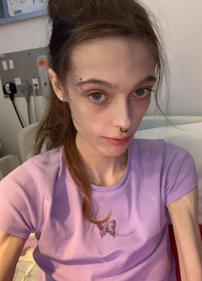 buns blog |🎄Cymraeg tweet media