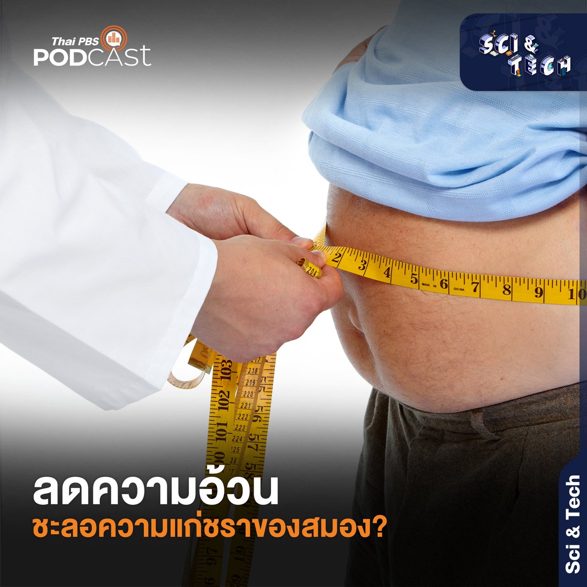 ThaiPBSPodcast's tweet image. #SciAndTech ชวนฟังเรื่อง #ความอ้วน ที่มีผลต่ออายุชีวภาพของ #สมอง ว่า ความอ้วนทำให้สมองแก่กว่าวัยจริงหรือไม่ และการ #ลดน้ำหนัก ช่วยให้สมองดีขึ้นได้อย่างไรบ้าง

🎧 Website | thaip.bs/srkjmyv
🎧 Spotify | thaip.bs/MEXs92m

#ThaiPBSPodcast
#ThaiPBS