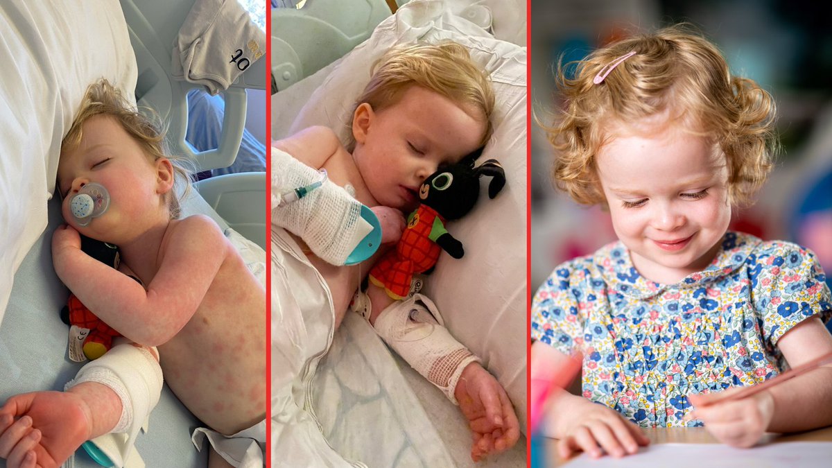 Cleo was just over two years old when she developed sepsis in April 2022 after having Strep A and RSV. Thankfully she’s much better now, but her mum Anna is sharing her story to prompt other parents to ‘Just Ask: Could it be sepsis?’ Read Cleo’s story: sepsistrust.org/about/about-se…