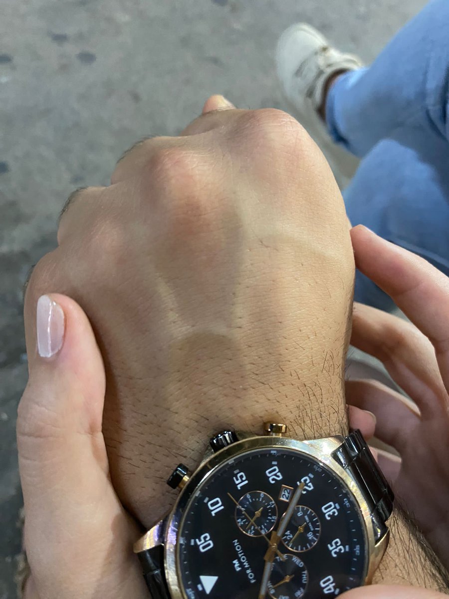 damarlarında benim bas harfimi tasiyo bu aşk değilde ne