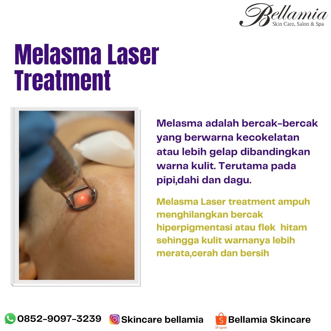 BellamiaCare tweet picture