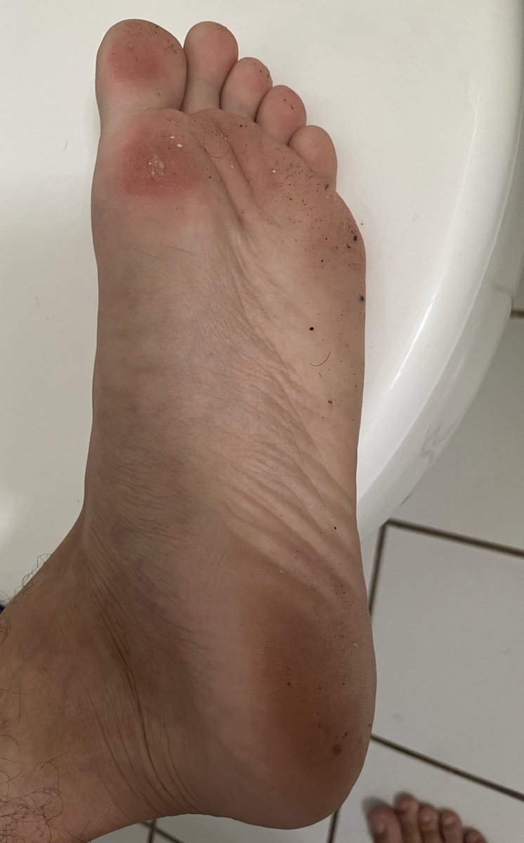 Jr feet tweet media