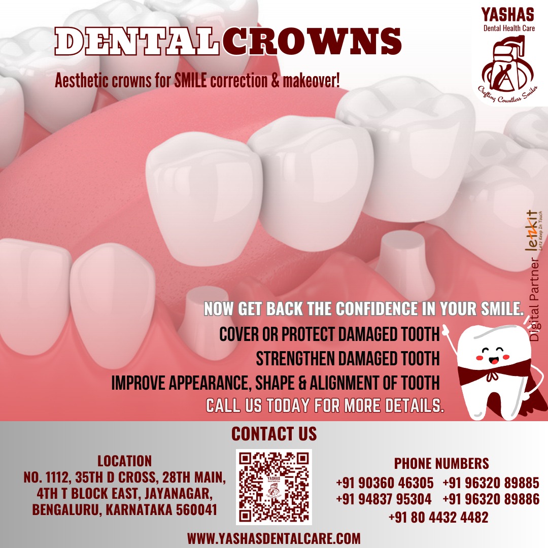SMILE correction &amp; makeover!

Get in touch with YASHAS today..!

#yashasdental #bangaloredentist #jayanagar #dentalcrowns #dentist #letzkit #bangalore