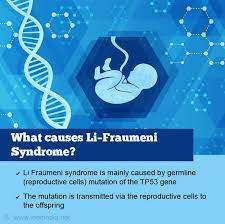 immunooncol's tweet photo. Li-Fraumeni syndrome (#LFS) is an inherited condition that is characterized by an increased risk for certain types of #cancer.  Affected people often develop cancer at an earlier age than expected and may be diagnosed with more than one cancer during their #lifetime. https://t.co/SoTgfXEERz