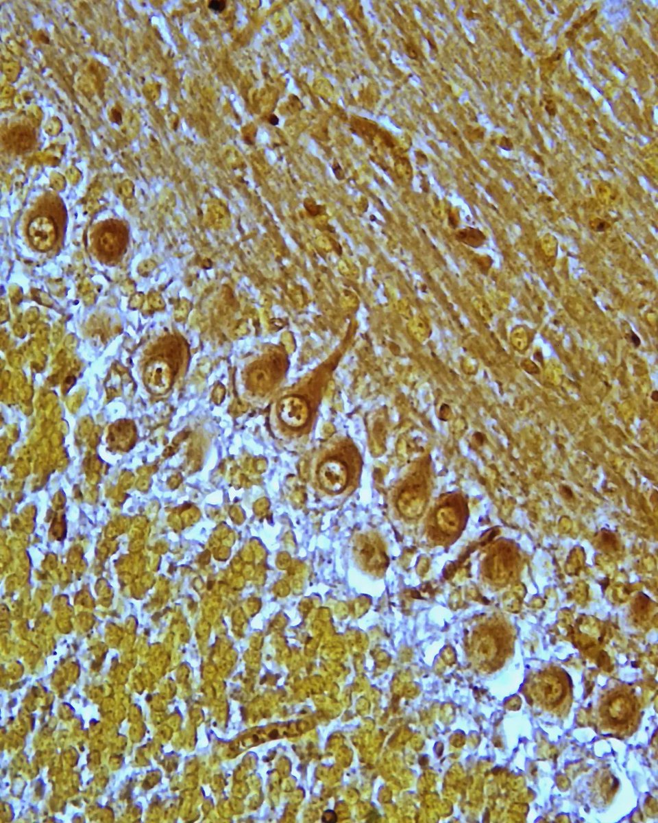 olkazuraw's tweet photo. Purkinje cells in the cerebellar cortex stained with Golgi stain (silver stain)

Photographed by: Path4K by  @iMillerMicroscopes

#microscopicphotography #microscopy #pathart #pathologyart #digitalart #microphoto https://t.co/QaRrxEQvs1