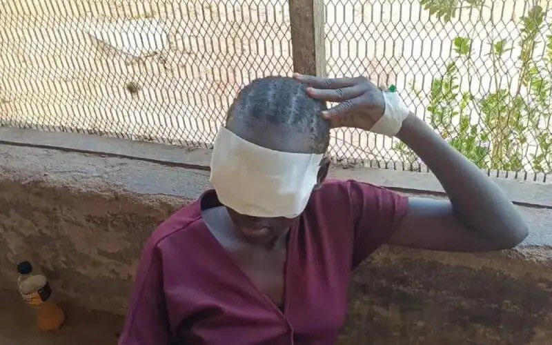 48Nasreen's tweet photo. في جنوب السودان قام شرطي باقىَلاع عينين ابنتيه
⬇️⬇️ https://t.co/dW1dHZ9Orm