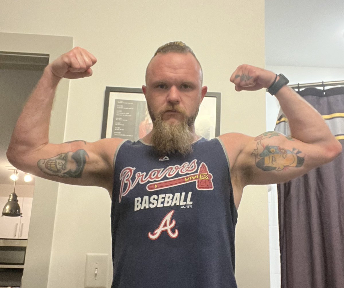 TheBoozerweight's tweet photo. My new favorite game is called “Can You Spot The Surgically Repaired Arm?”. #BionicBoozerweight https://t.co/2Ly6gpWxm7