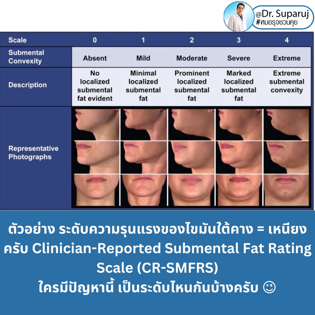 RujSuparujรุจชวนคุย tweet media