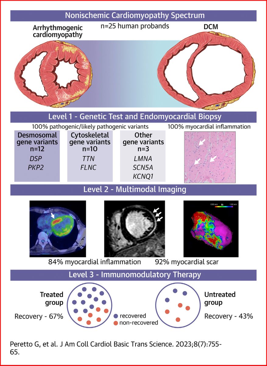 JACC Journals (@jaccjournals) on Twitter photo Use of multimodal imaging in genetic cardiomyopathies may allow for the identification of myocardial inflammation potentially responsive to immunomodulatory therapy.
Read the new #JACCBTS study by <a href="/GiovanniPeretto/">Giovanni Peretto</a> et al here: bit.ly/3Y7BTSI
#HeartFailure #CardioRheum Use of multimodal imaging in genetic cardiomyopathies may allow for the identification of myocardial inflammation potentially responsive to immunomodulatory therapy.
Read the new #JACCBTS study by <a href="/GiovanniPeretto/">Giovanni Peretto</a> et al here: bit.ly/3Y7BTSI
#HeartFailure #CardioRheum