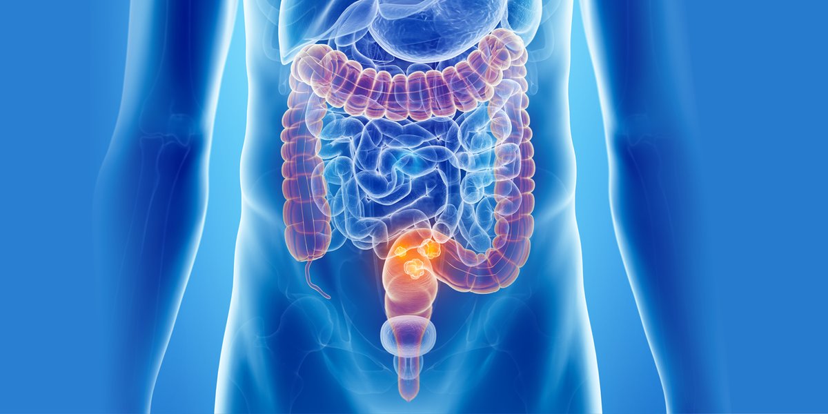 Fondazione Oncologia Niguarda Onlus tweet media