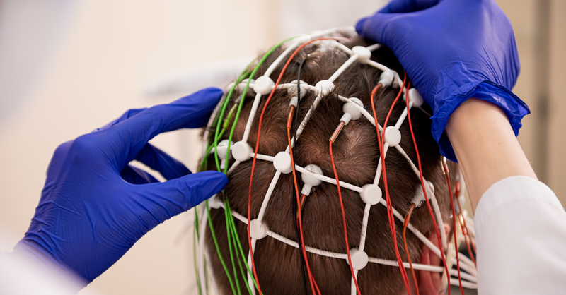 FrontiersIn's tweet photo. Parkinson's disease (PD) is a complex neurodegenerative disorder. A better understanding of PD could lead to more effective therapeutic interventions and improved patient outcomes.

Read our trending articles on Parkinson's disease ⬇