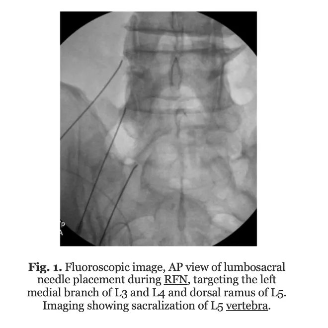 Interventional Pain Medicine tweet media
