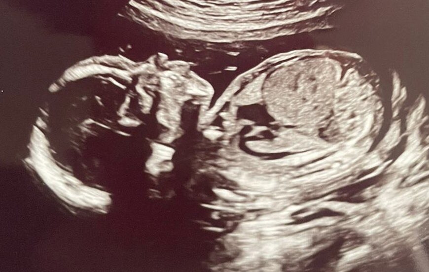 Victoria Fensome tweet media