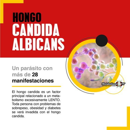 La real causa de la obesidad es un hongo llamado CANDIDA ALBICANS. 
Recuerda bien esta palabra: CAO. Coco, ajo y orégano, consume diariamente. 
Ahora, recuerda esta otra palabra: TAM. Trigo, arroz y maíz, no debes consumir. 
Y lo principal: NADA EN EXCESO.
Y recuerda, siempre lo