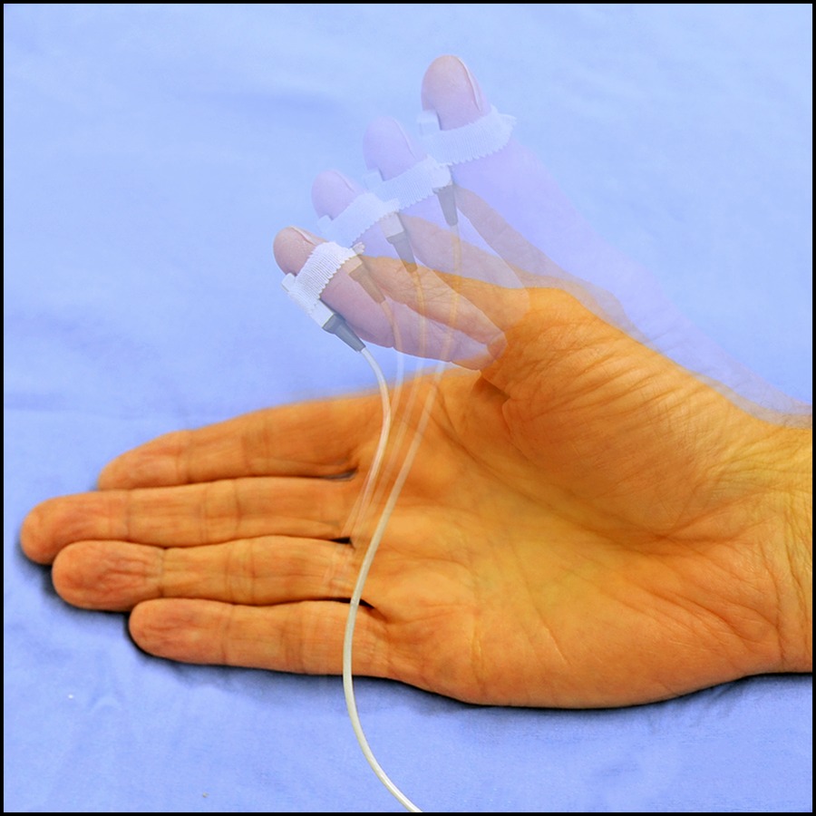 Recent <a href="/ASALifeline/">ASA®</a> practice guidelines provide evidence-based recommendations on the management of neuromuscular monitoring and antagonism of neuromuscular blocking agents during and following general #anesthesia. Read the guidelines: ow.ly/sqn050PkQ3w