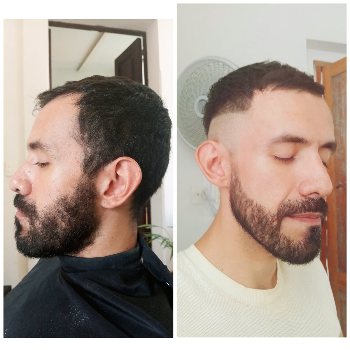 No puedo hacer crecer el cabello pero podemos disimular muchísimo el área de  entradas ,