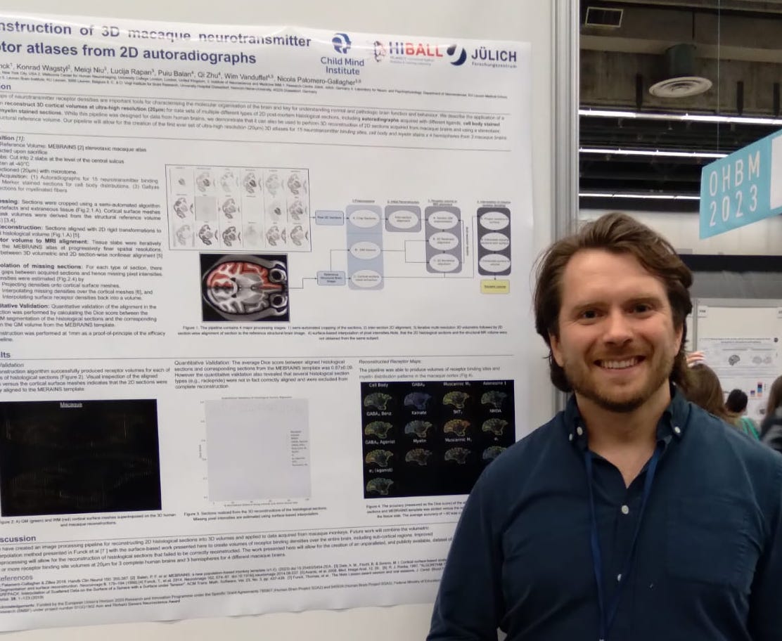 BigBrain (@bigbrainproject) on Twitter photo If you missed him today meet <a href="/tffunck/">Thomas Funck</a> at poster 2428 #OHBM2023 tomorrow to learn how to create 3D receptor atlases from 2D autoradiographs. <a href="/receptorworld/">Nicola Palomero</a> <a href="/fz_juelich/">Forschungszentrum Jülich | @fzj@social.fz-juelich</a> <a href="/childmindinst/">Child Mind Institute</a> If you missed him today meet <a href="/tffunck/">Thomas Funck</a> at poster 2428 #OHBM2023 tomorrow to learn how to create 3D receptor atlases from 2D autoradiographs. <a href="/receptorworld/">Nicola Palomero</a> <a href="/fz_juelich/">Forschungszentrum Jülich | @fzj@social.fz-juelich</a> <a href="/childmindinst/">Child Mind Institute</a>