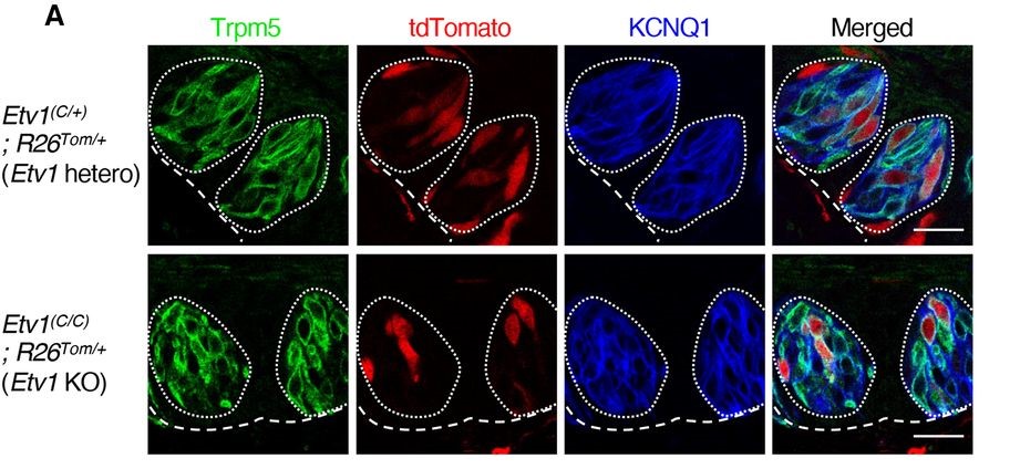 SfNJournals's tweet photo. #eNeuro: Ohmoto et al. @MonellSc found the transcription factor Etv1 in mice enables taste cells to detect nutritional substances &amp; evoke palatable tastes. If this molecule doesn't work, tastes that are sweet, umami, &amp; salty could be lost or compromised.
https://t.co/VyLJyiY2is https://t.co/LmpOQX0a8v