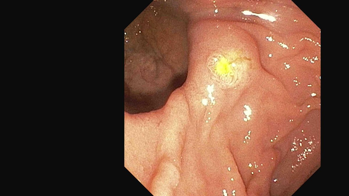 Douglas G. Adler MD, FASGE, FACG, AGAF tweet media