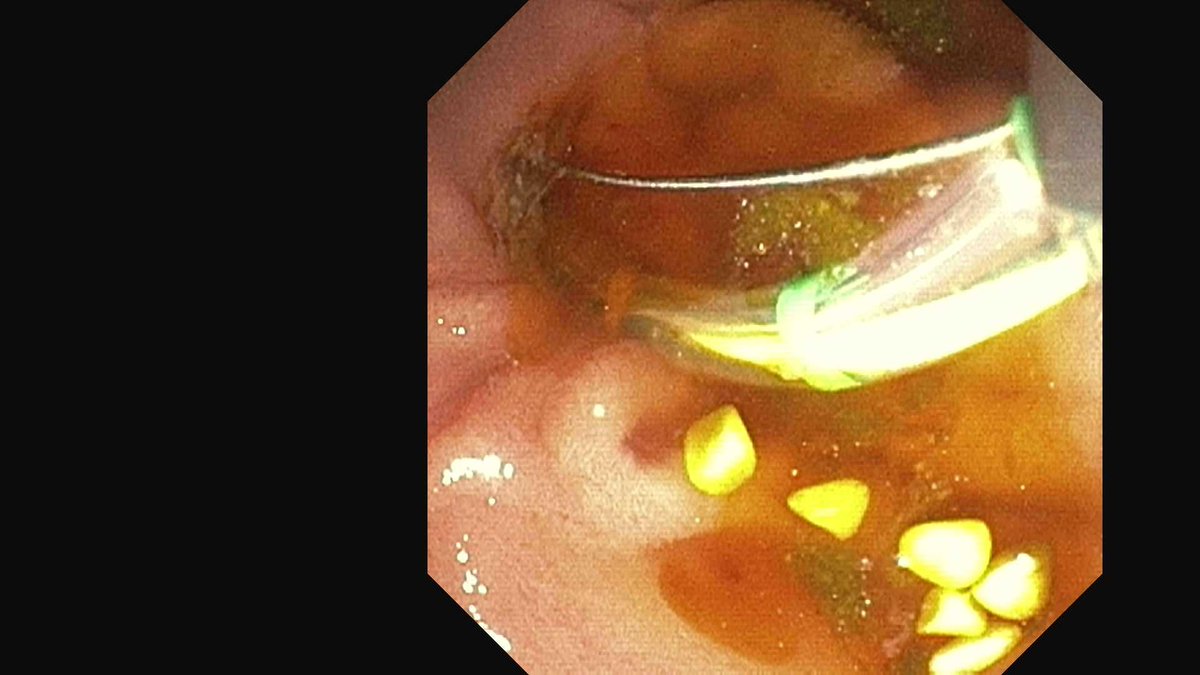 Douglas G. Adler MD, FASGE, FACG, AGAF tweet media