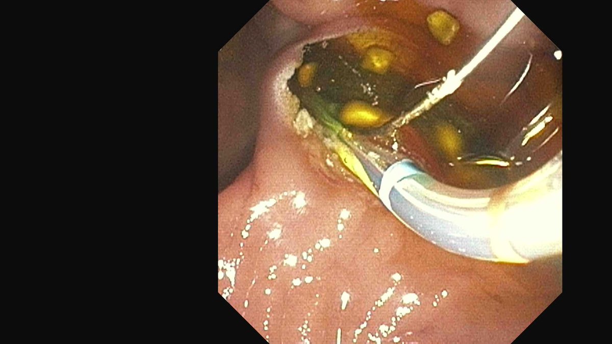 Douglas G. Adler MD, FASGE, FACG, AGAF tweet media