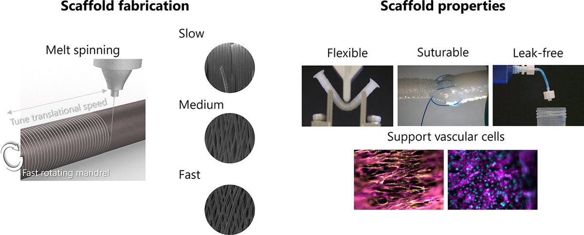 Hurray! The paper from my postdoc times at <a href="/MERLN_UM/">MERLN</a> is out in <a href="/ACSBiomaterials/">ACS Biomat Sci & Eng</a>!
Read about our "Flexible, Suturable, and Leak-free Scaffolds for Vascular Tissue Engineering Using Melt Spinning" here (available as open access) pubs.acs.org/doi/10.1021/ac…
A little tweetorial below ⬇️