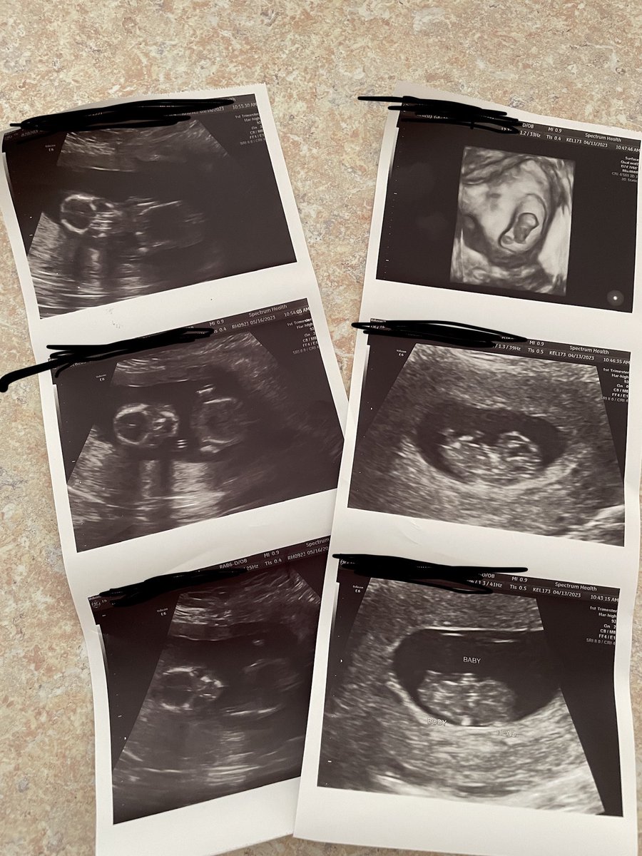 Ryan Fleischmann tweet media