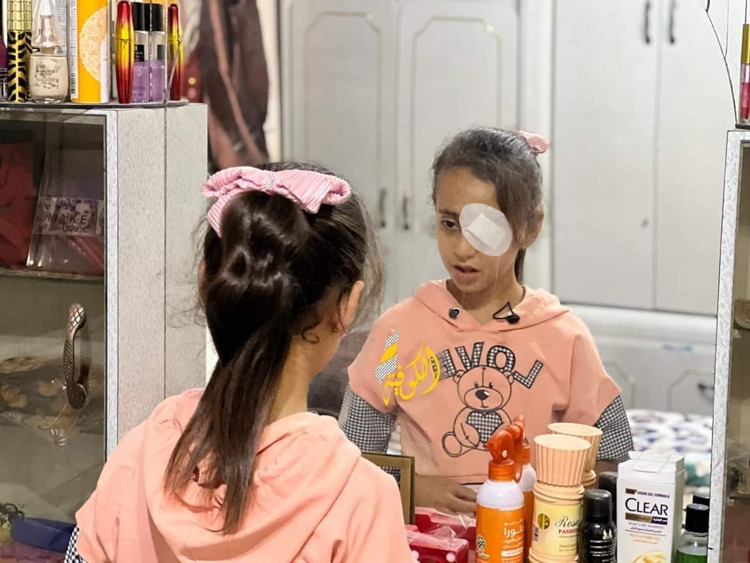 marhmoh5's tweet photo. An Israeli missile loses this innocent child one of her eyes
Words cannot express the extent of her pain, but she has not lost hope for a better future 🙏😞
Areej needs a prosthetic eye and several treatment procedures
Please donate to help this poor girl https://t.co/FyEaZo7faV https://t.co/WWSVdogL42