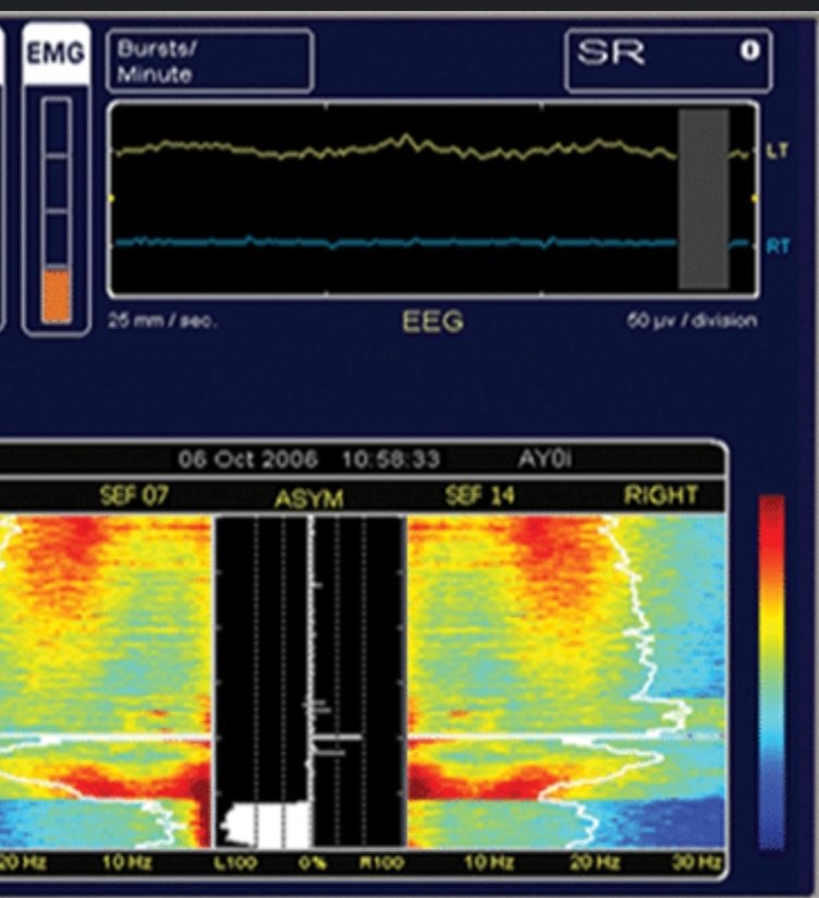 St George's anaesthetic department 🌈 tweet media