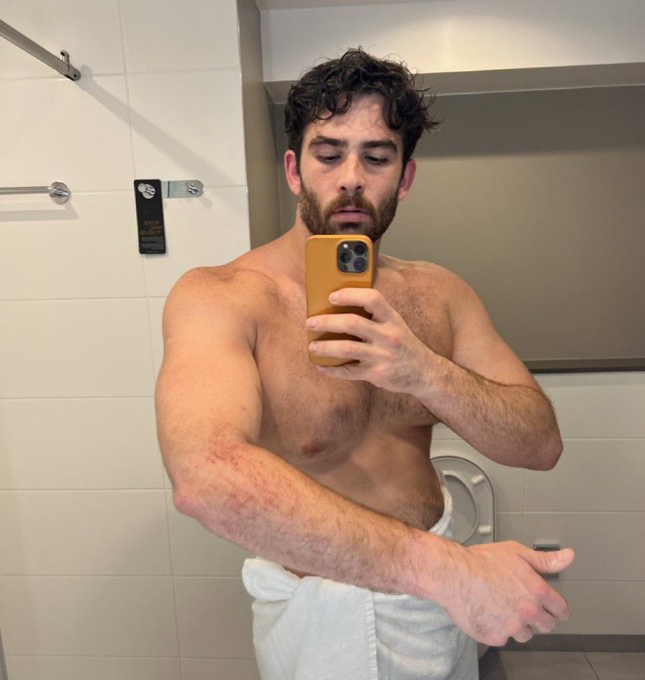 queuebetweeting's tweet photo. I heard it’s #hasantwtselfieday (shirtless hotel injury pic edition) I guess it’s his birthday too idk #happyhasday he just keeps getting older huh https://t.co/U4F6TLQIZx