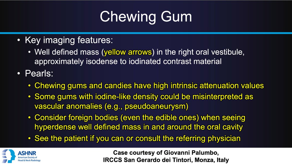 #ASHNRCOTW #222 ANSWER: Chewing gum! Thx Dr. Palumbo 4 case! #ASHNR23 @AshokSrini15 @callyrobs @DShatzkes @CDP_Rad @rhwiggins @nakoontz @cmtomblinson @WmOBrienDO @ESHNRSociety @tabby_kennedy @AnnJayMD1 @CMGlastonbury @CharBranstetter @PhilipRChapman1 @RadRupa @kmmosier @phudge54