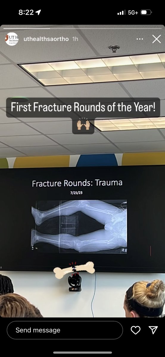 Really good learning tonight at our first trauma fracture rounds of the year🦴#orthotwitter #MedTwitter