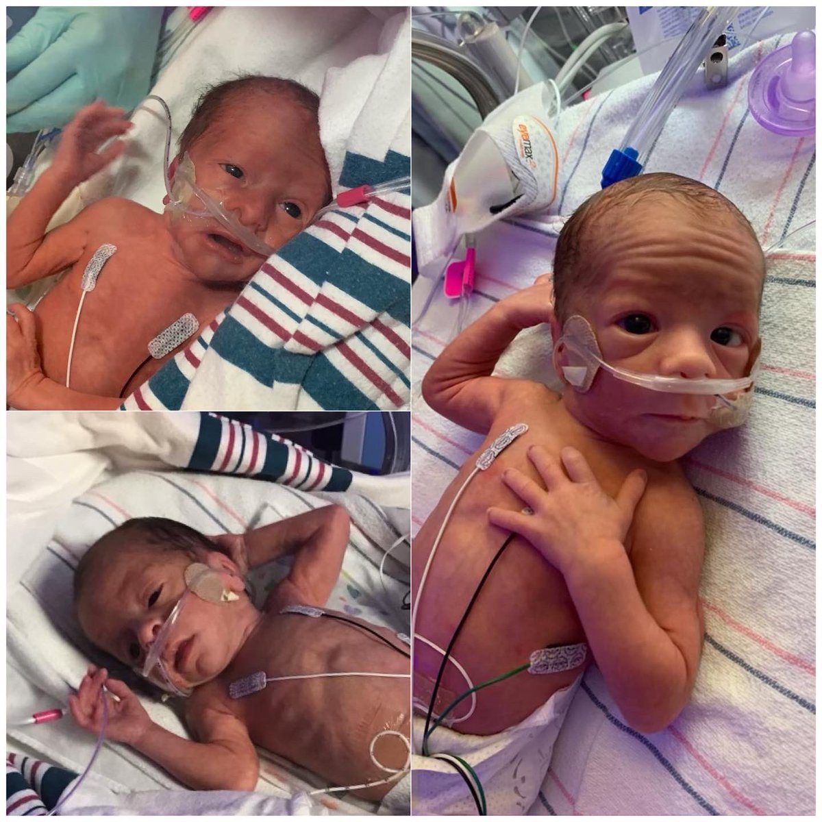 NEEKSFSU's tweet photo. The Motta Triplets
 
Jaxon Rolando Motta (3lbs 10oz) 17 1/4 inches 

Malachi Miles Motta (4lbs 1oz) 17 1/4 inches 

Eliana Neva Motta (3lbs 5oz) 16.25 inches  

Our beautiful triplet babies entered the world on 7–22-23 .. https://t.co/lV1xghB4M9