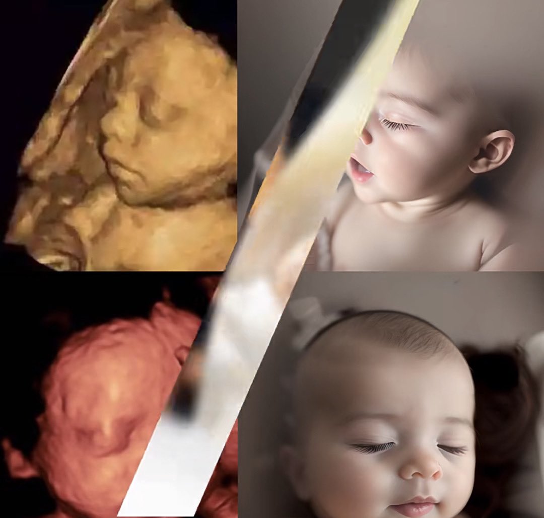 🌈Ai变现赚钱项目里面，看到很多人说四维彩超预测宝宝长相方法，这种若是根据提示词 那就大同小异，有虚假宣传的成分在里面。不过我们换个思路升级下操作。不妨结合孩子爹妈长相融合下，再用到insightface，那岂不完美预测了