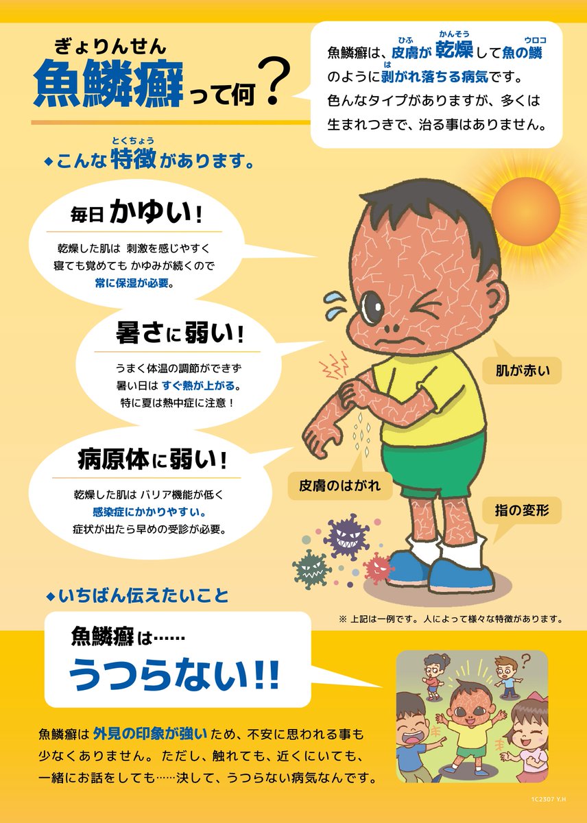 k4DR3qMip6brA06's tweet image. 「魚鱗癬(ぎょりんせん)」という病気をカンタンに説明する画像を作りました。(計４枚)
#魚鱗癬　#Ichthyosis　#説明イラスト