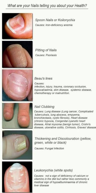 Anemia and Skin Findings (along with Nail Changes and Mouth Sores) - YouTube