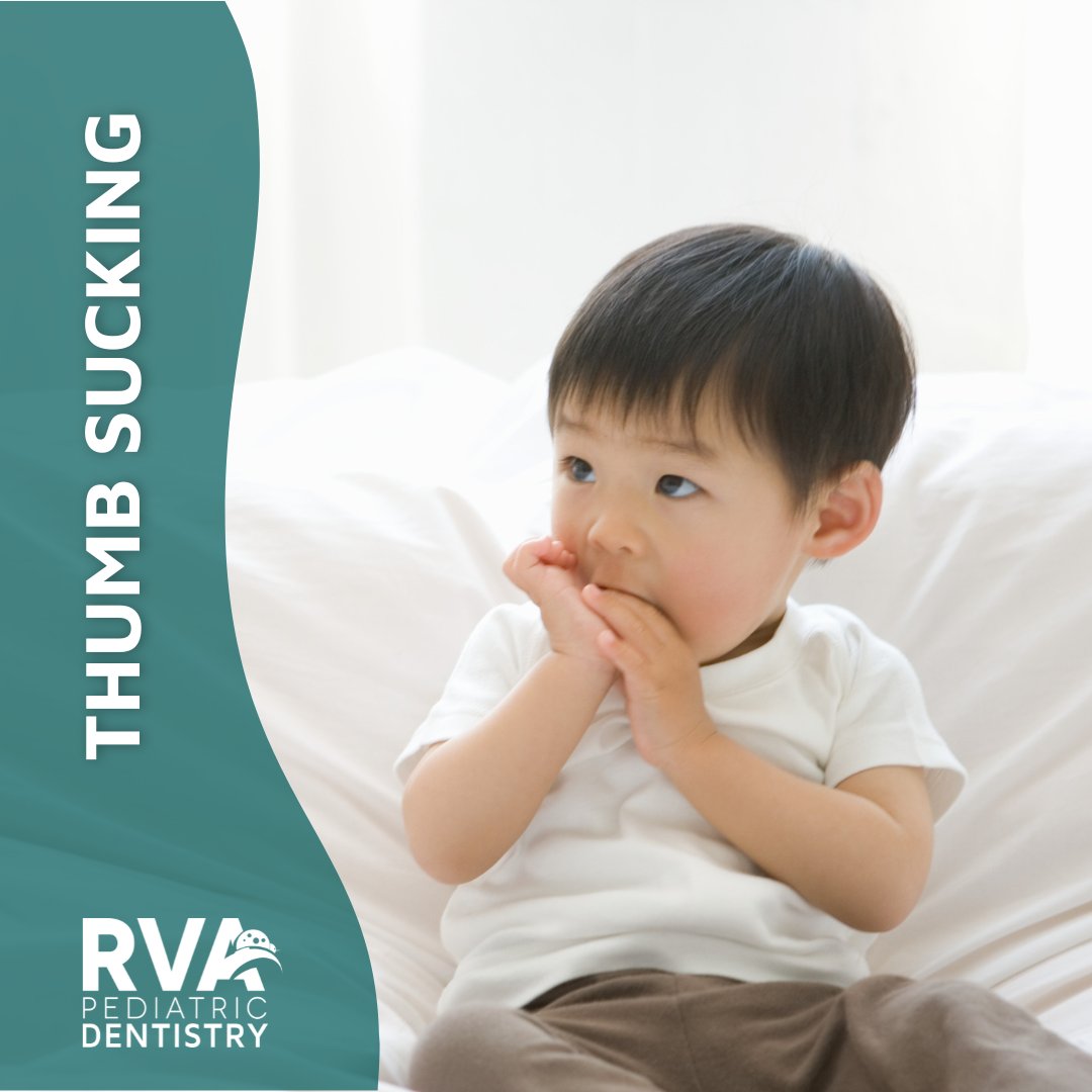 PediatricRva's tweet image. If thumb sucking continues past the age of 4, this can affect the growth and alignment of the bite, leading to an open bite or overbite.

If you are concerned about their thumb sucking habit, we are happy to answer any of your questions at (804) 220-6188.

#ThumbSucking #Overbite