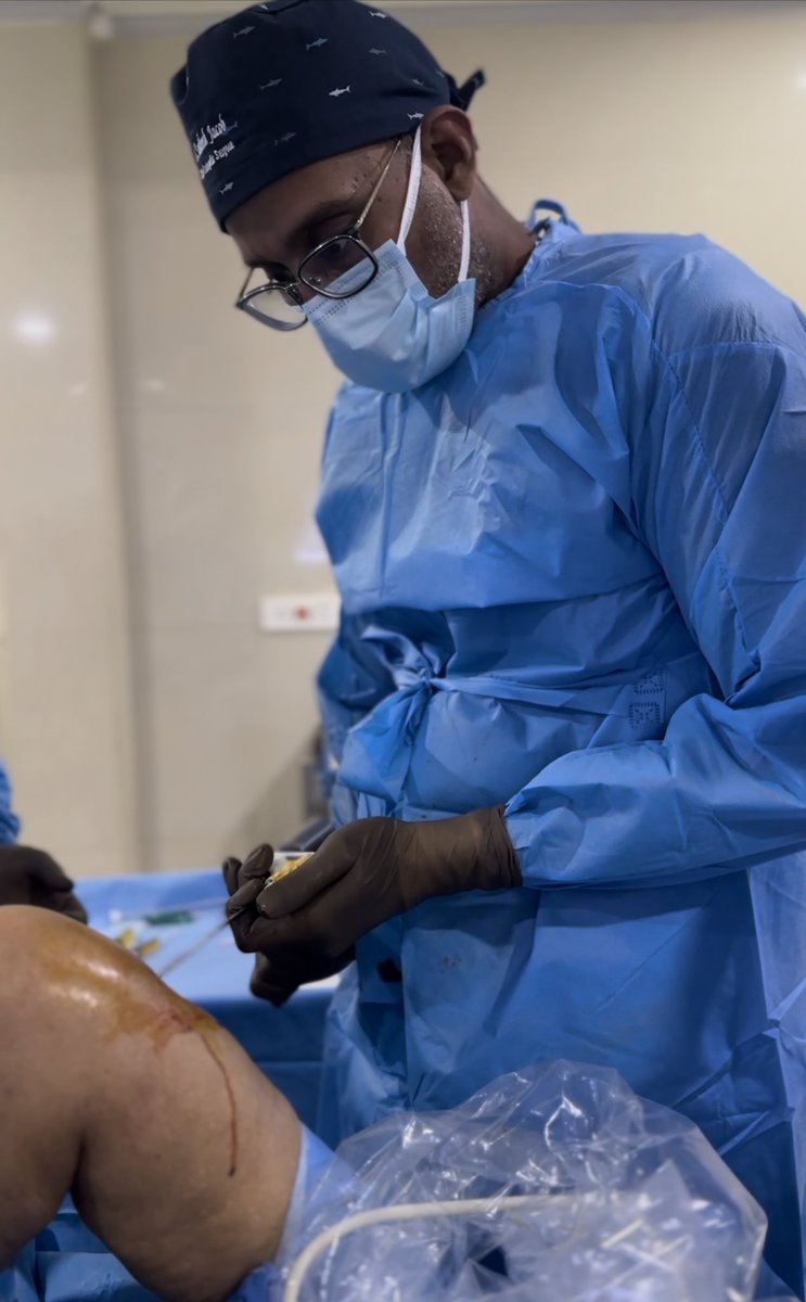 Drsanthoshjacob's tweet photo. Bone marrow concentrate ( BMAC ) is implanted into the bone of the knee and cartilage in osteoarthritis to help treat symptoms and improve mobility.
Results are short lived in severe osteoarthritis with deformity which will require a knee replacement.

#bonemarrowconcentrate https://t.co/jM654NWXjO