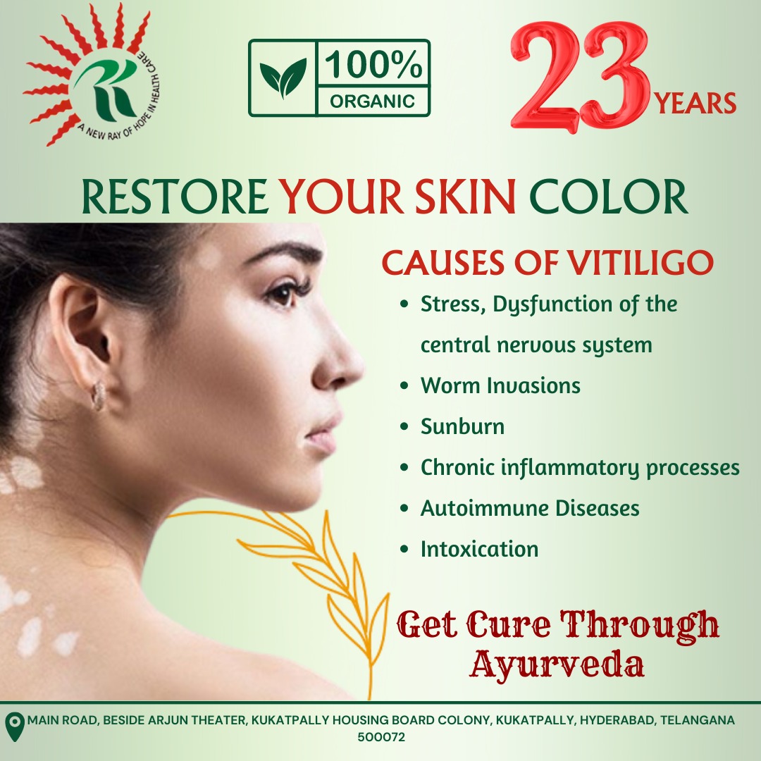 Unlock the Power of Ayurveda: Embrace Your Skin's Unique Beauty with RK Ayurvedic's Vitiligo Treatment! 🌟💚

#RKAyurvedic #VitiligoTreatment #EmbraceYourBeauty #AyurvedicWisdom #NourishFromWithin #JourneyOfSelfLove #ConsultationAvailable #NatureGifts #RadiateConfidence