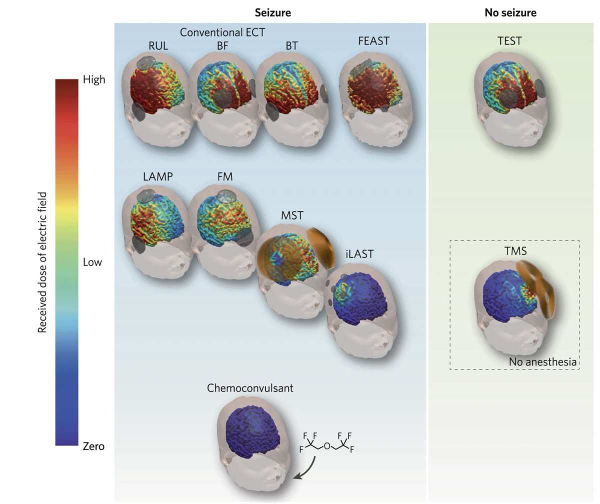 New review online in <a href="/npp_journal/">Neuropsychopharmacology</a> as part of #NPPR2024, "How electroconvulsive therapy works in the treatment of depression: is it the seizure, the electricity, or both?"
<a href="/ZhiDeDeng/">Zhi-De Deng</a>  <a href="/SarahLisanbyMD/">Sarah "Holly" Hollingsworth Lisanby, MD</a>
nature.com/articles/s4138…