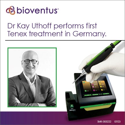 Bioventus (@bioventusglobal) on Twitter photo Dr. Kay Uthoff completed the first Tenex™ treatment in Germany! His patient who had a medial epicondylitis, received the treatment in 2-3 minutes.
#ChronicPain #Epicondylitis
Individual results may vary.
Full prescribing info: bioventus.com/de
CC@bioventusglobal.com Dr. Kay Uthoff completed the first Tenex™ treatment in Germany! His patient who had a medial epicondylitis, received the treatment in 2-3 minutes.
#ChronicPain #Epicondylitis
Individual results may vary.
Full prescribing info: bioventus.com/de
CC@bioventusglobal.com