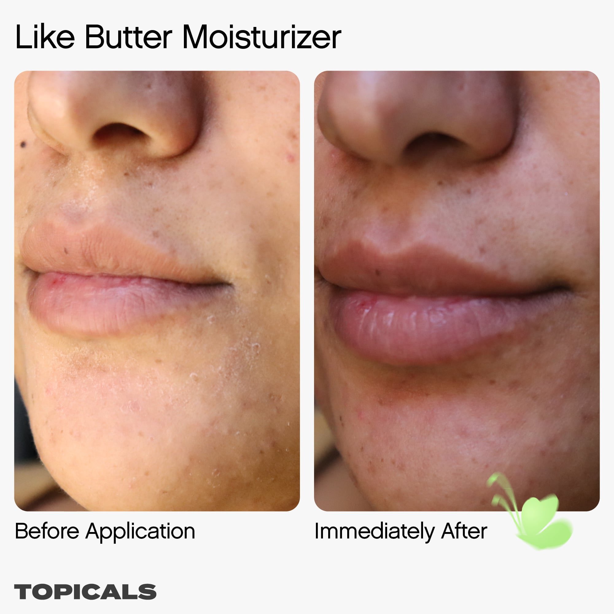 rolle det tvivler jeg på Compulsion Tiara Willis on X: "Like Butter by @topicals - 15% sale off here: For my girlies with dry skin, eczema, itching and irritating This is what I recommend for when my skin rolle det tvivler jeg på Compulsion Tiara Willis on X: "Like Butter by @topicals - 15% sale off here: For my girlies with dry skin, eczema, itching and irritating This is what I recommend for when my skin