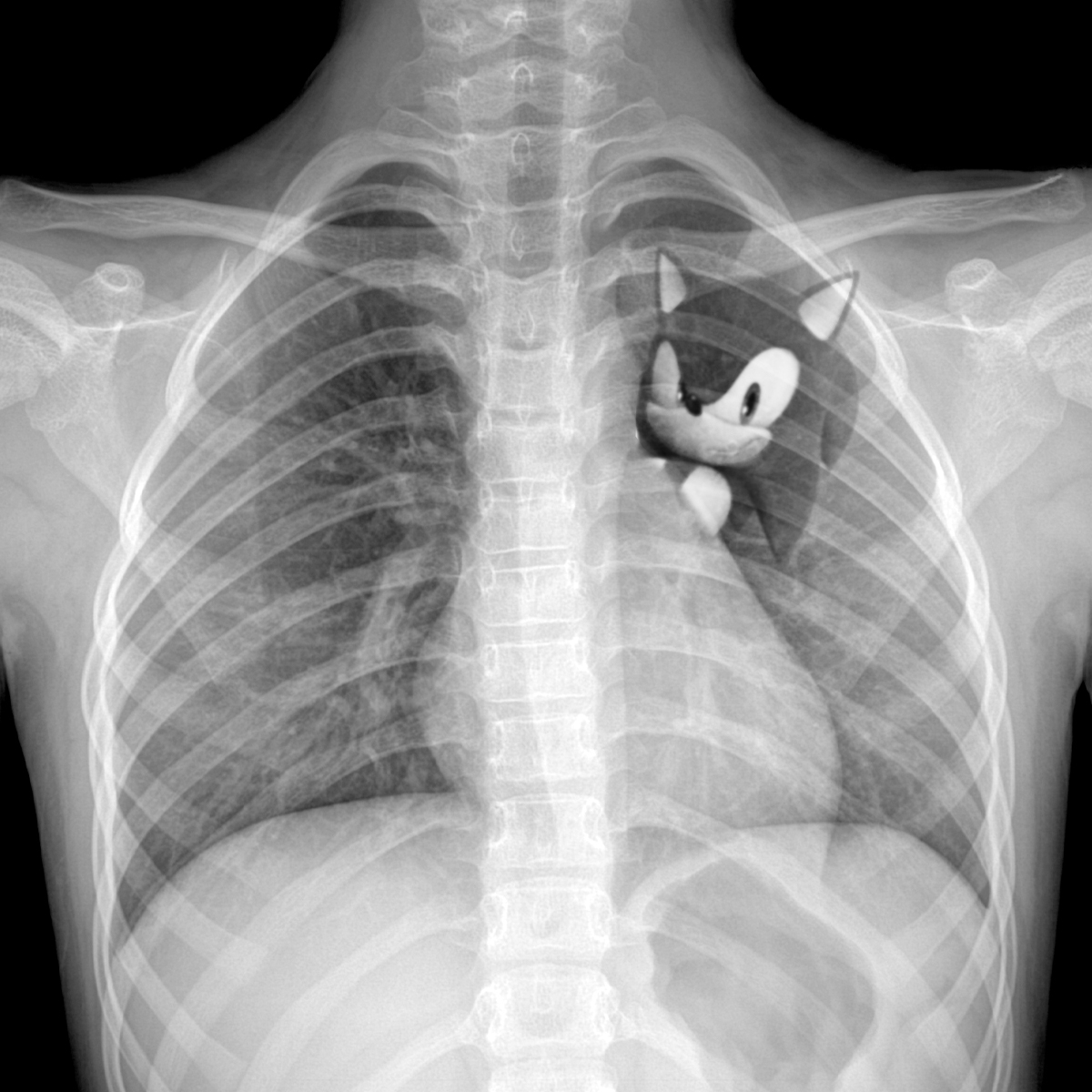 SnazzySonic on Twitter "RT sonic_hedgehog The Xrays are back and