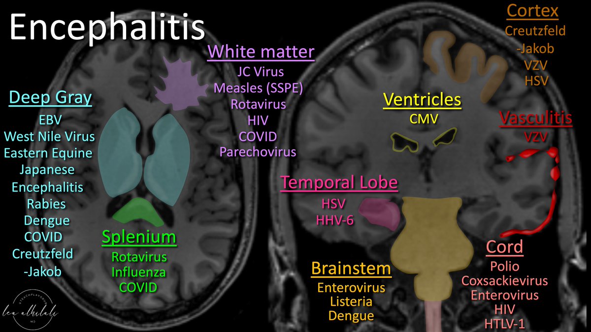 Knowledge is contagious!

Infectious encephalitis can be a difficult diagnosis, but patterns on MRI can suggest an etiology

Here is a figure to help you remember the most *common* encephalitis patterns for different organisms

#medtwitter #meded #FOAMed #neurotwitter #radres
