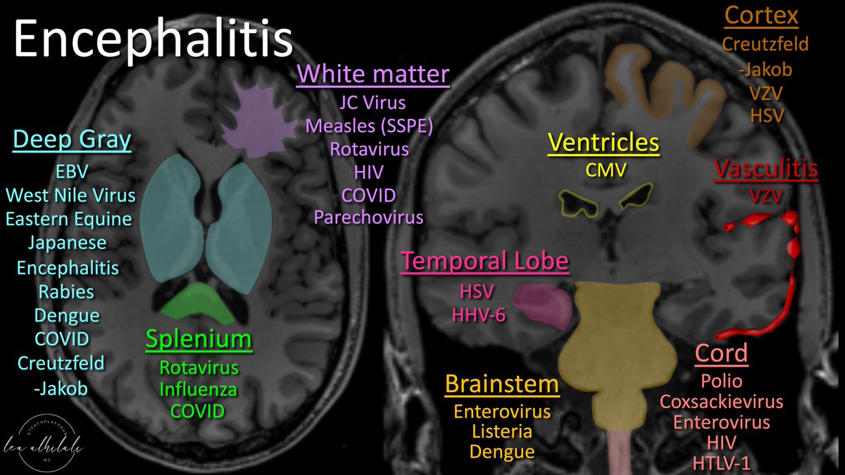 Knowledge is contagious! Infectious encephalitis can be a difficult diagnosis, but patterns on MRI can suggest an etiology Here is a figure to help you remember the most *common* encephalitis patterns for different organisms #medtwitter #meded #FOAMed #neurotwitter #radres