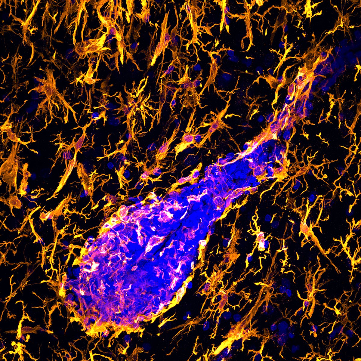 DaniBeckman's tweet photo. An abnormal blood vessel arrives on a sea of activated microglia. Bringing more fighters to the battle? They are fighting against misfolded Tau in an Alzheimer's model. Staining: Dapi (blue), Iba1 (yellow) @zeiss_micro  #NeuroTwitter #FluorescenceFriday https://t.co/w8JA0qjgKk