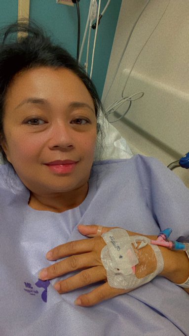 Before and after my micovascular decompression surgery on Wednesday. Now, let the healing begin! https://t<a href="/tag/genbbq"class="tags"><span>#genbbq</span></a>
