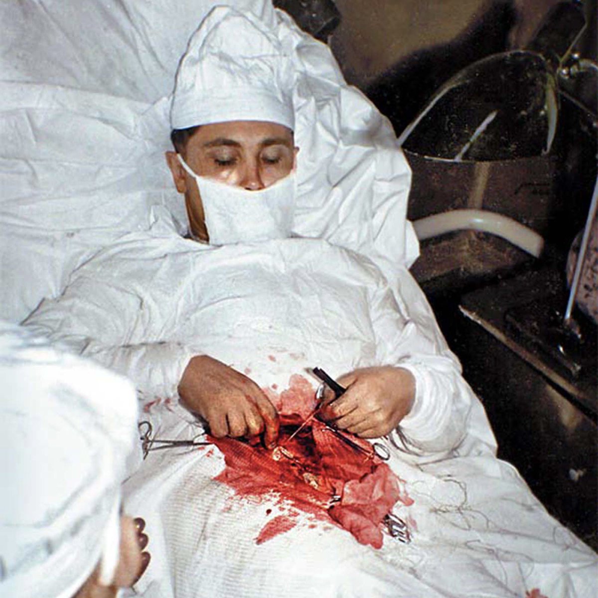 itsmedicalway's tweet photo. 27-year-old doctor performing surgery on himself 😨 https://t.co/R3ViXlkwOS