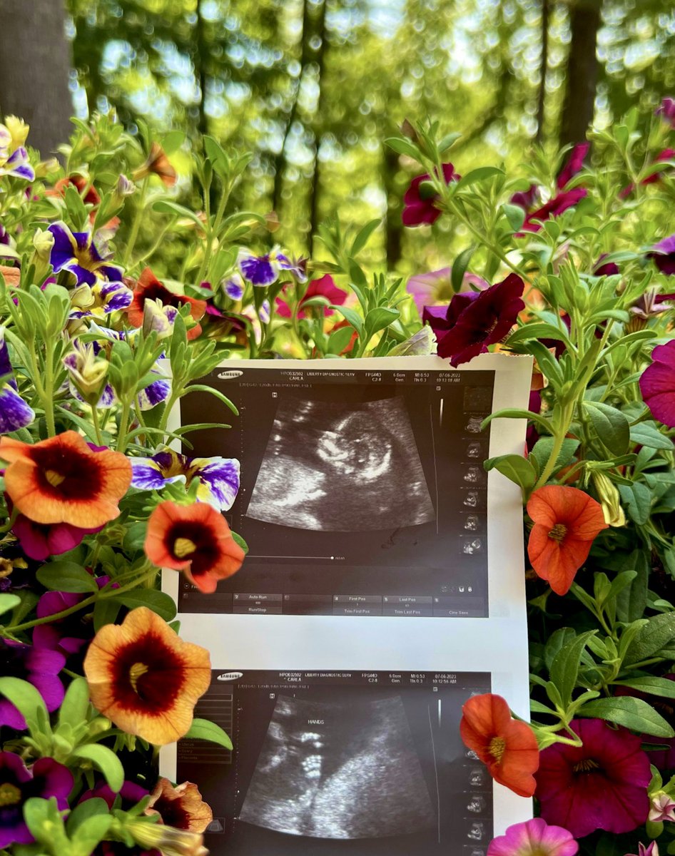 CARLA⚡️ tweet media